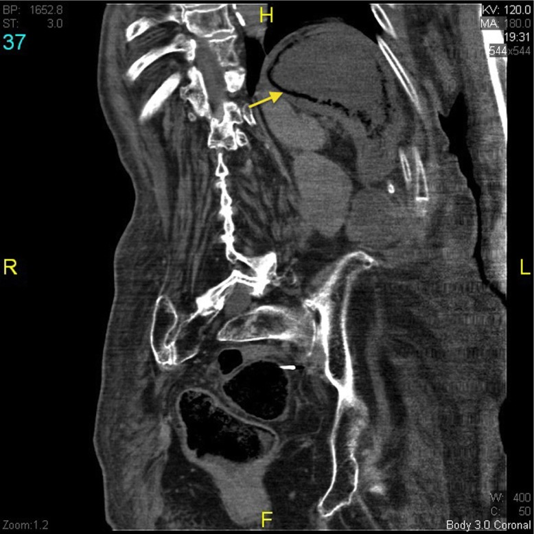 Fig. 2