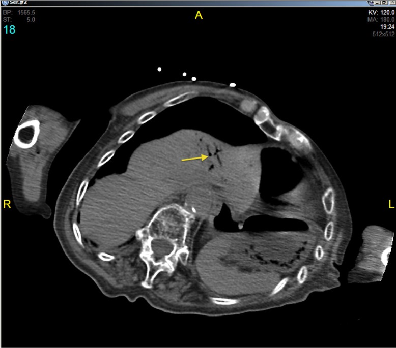 Fig. 4