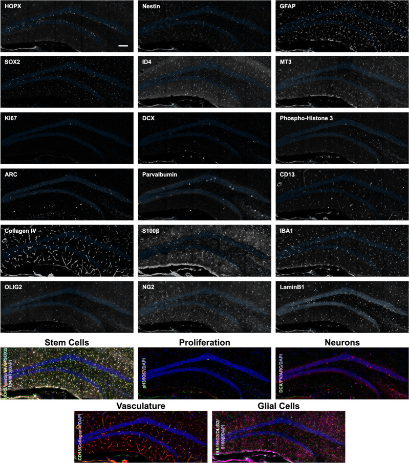 Figure 2—figure supplement 4.