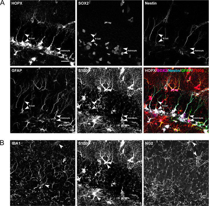 Figure 3—figure supplement 1.