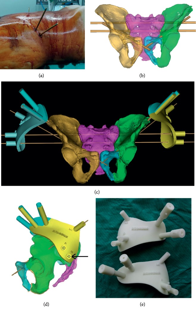 Figure 1