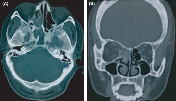 FIGURE 1