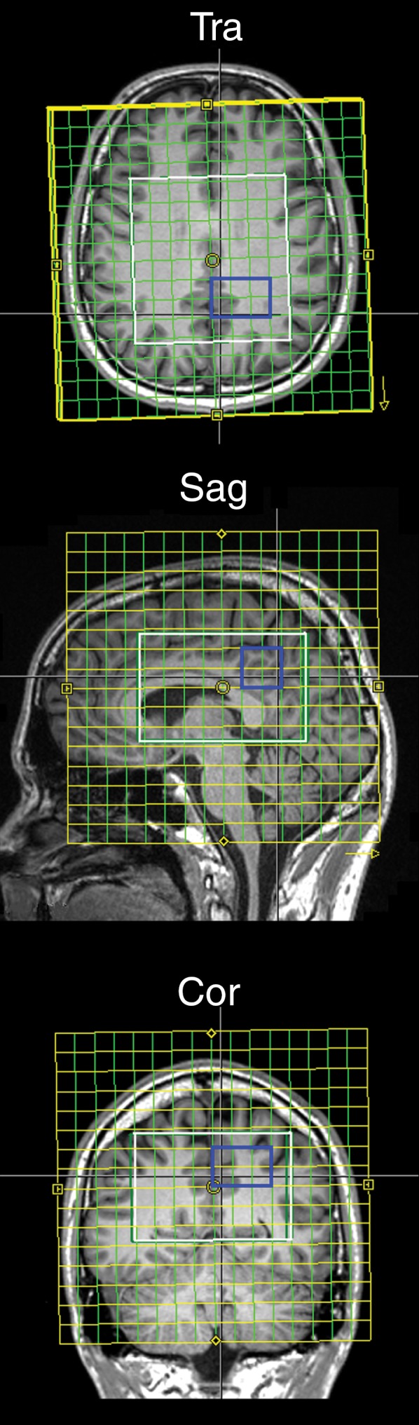 Figure 1a: