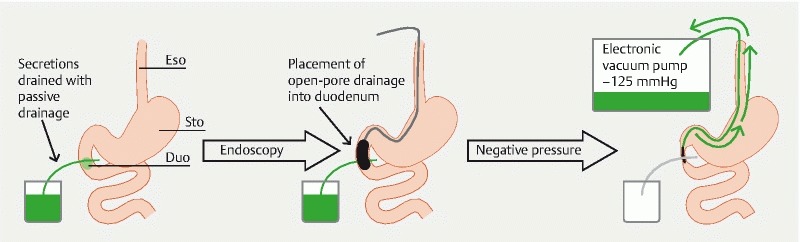 Fig. 3