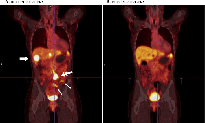 Fig. 2