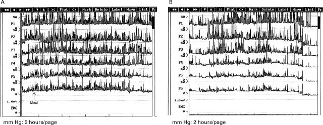 Figure 2  