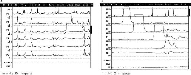 Figure 1  