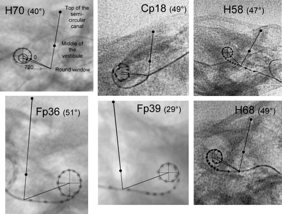 Fig. 2