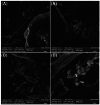 Fig 13