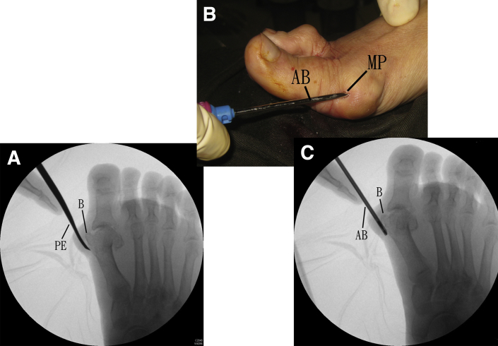 Fig 11