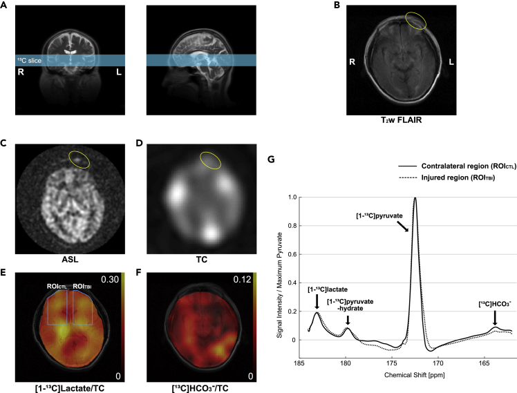 Figure 3