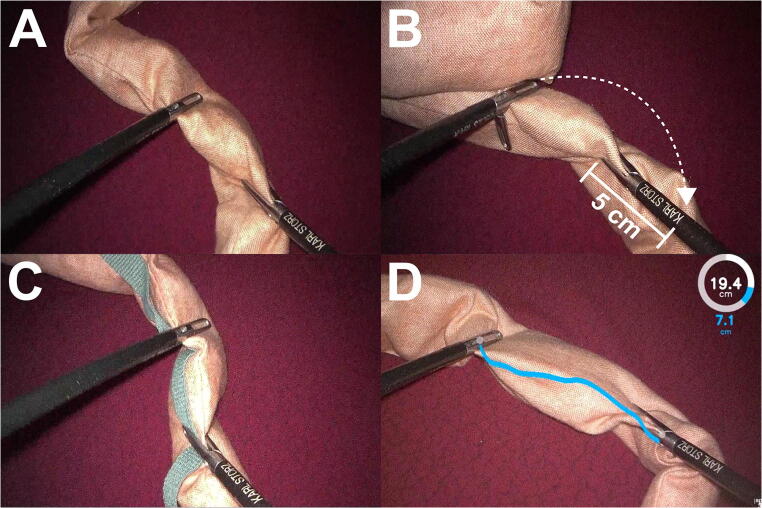 Fig. 1