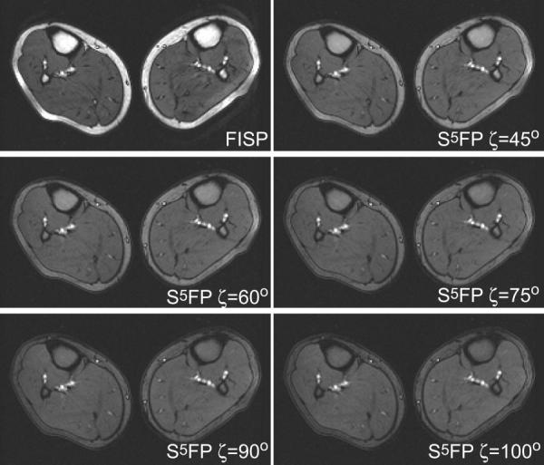 FIG. 7