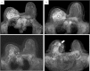 Fig. 2