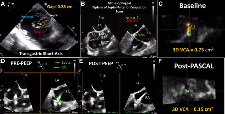 Figure 3