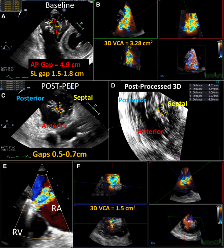 Figure 2