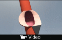 Video Graphic 1.