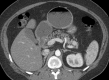 Figure 3b