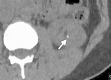 Figure 16d