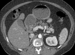 Figure 3a
