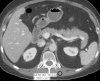 Figure 12b