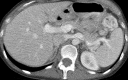 Figure 2a