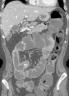 Figure 15d