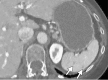 Figure 14d