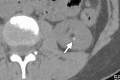 Figure 16b