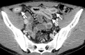 Figure 7a