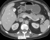 Figure 12a