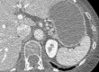 Figure 14a
