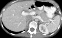 Figure 2b