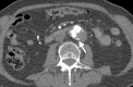 Figure 5a