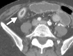 Figure 15a