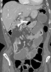 Figure 15b