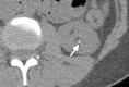 Figure 16a