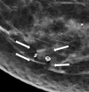 Figure 8b.