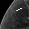 Figure 5a.