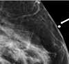 Figure 2c.