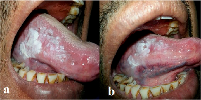Fig. 3