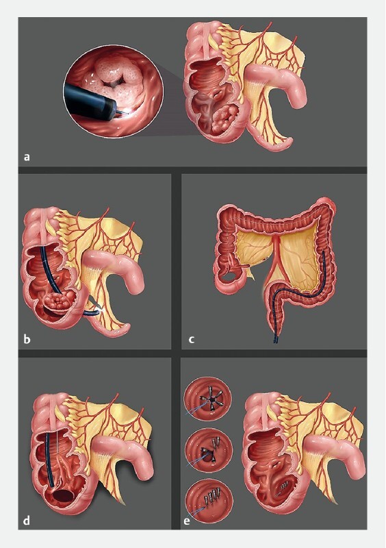 Fig. 1 