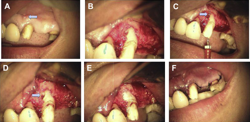 Figure 6