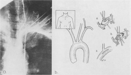 Fig. 13.