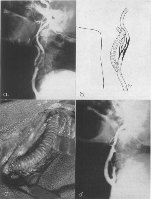 Fig. 12.