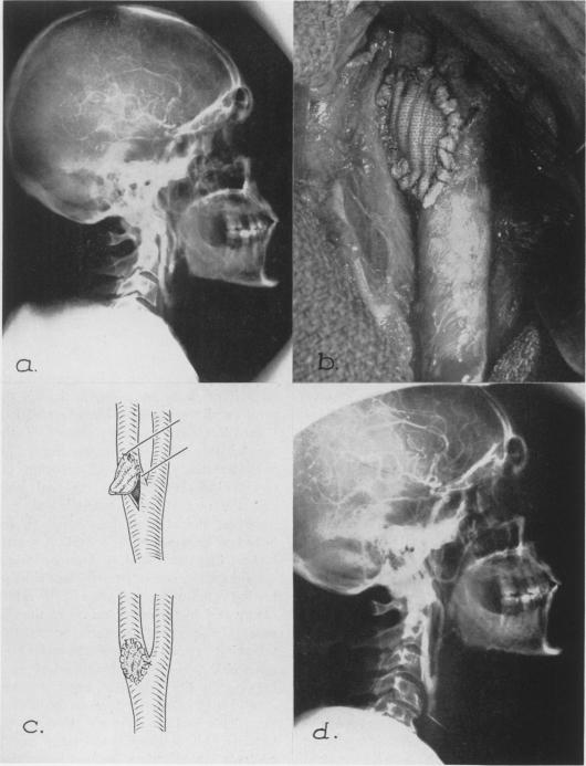 Fig. 11.