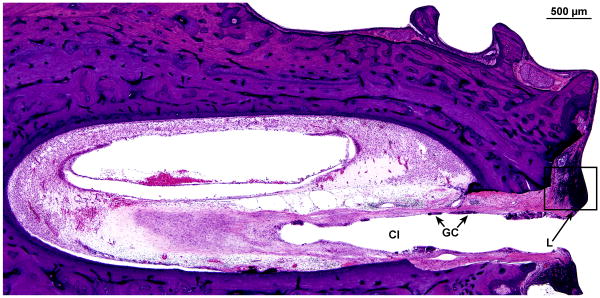 FIG. 11