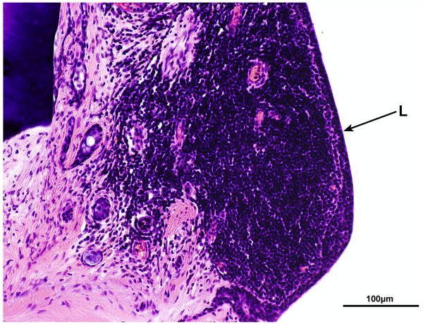 FIG. 11