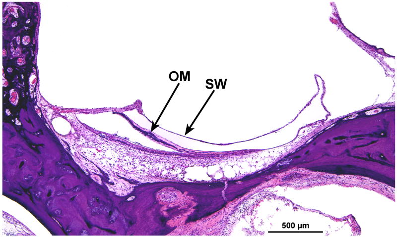 FIG. 13