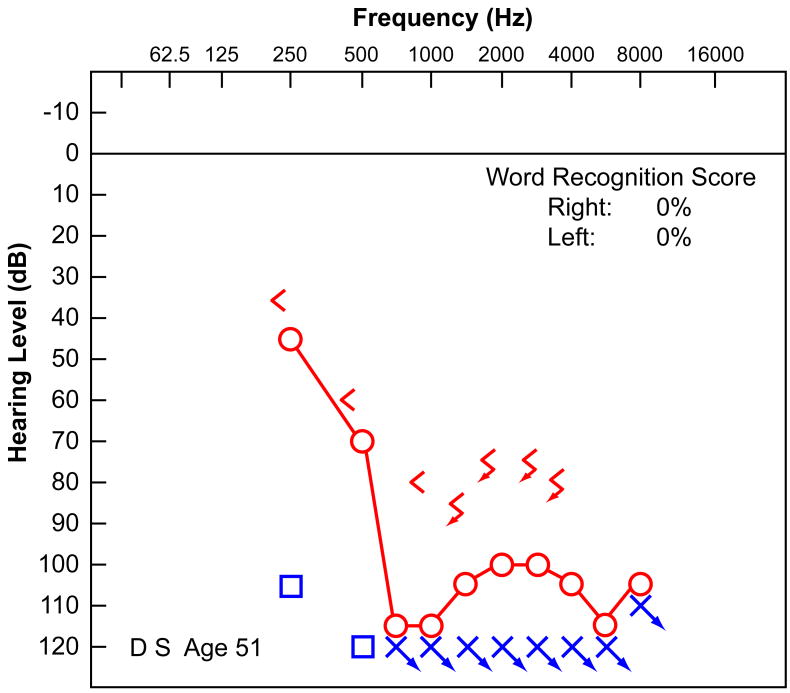 FIG. 1